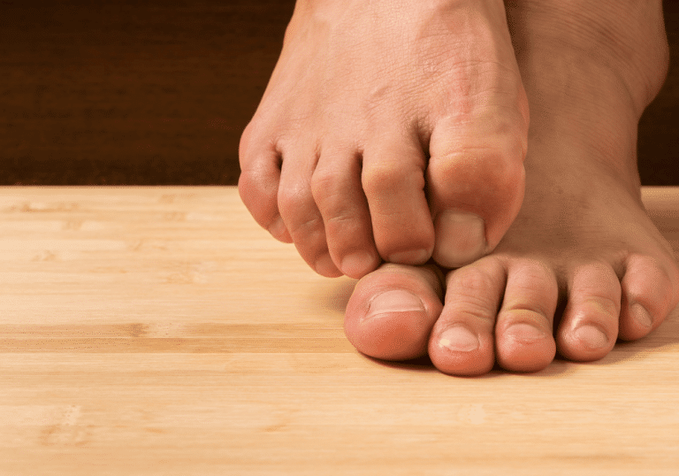 hallux-limitus-foot-mechanics